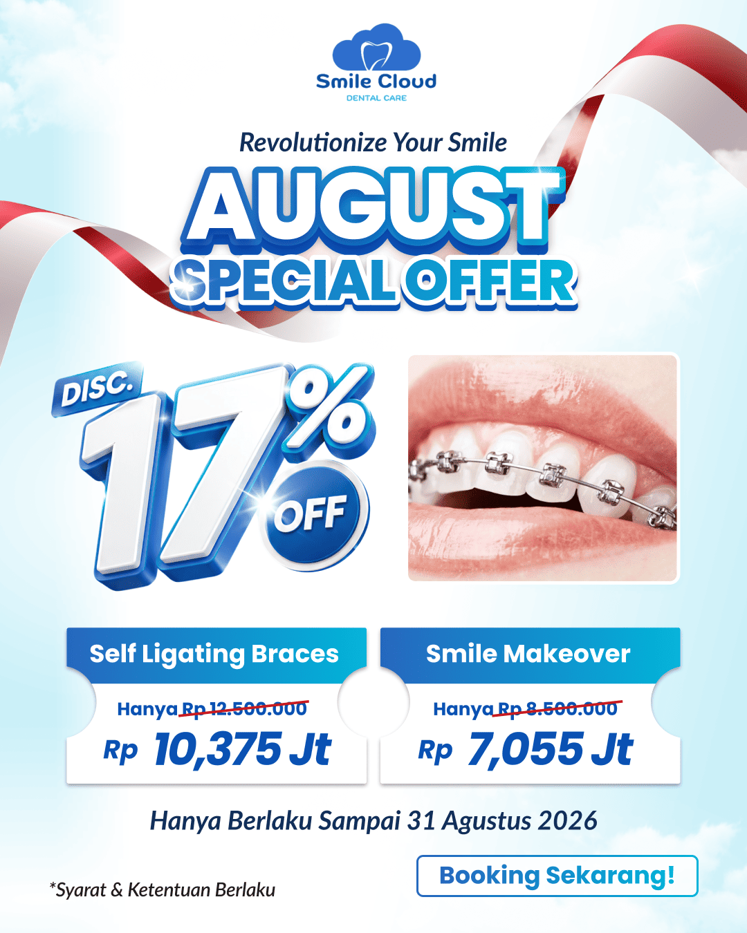 Promo Behel & Bleaching - Smile Cloud (1)